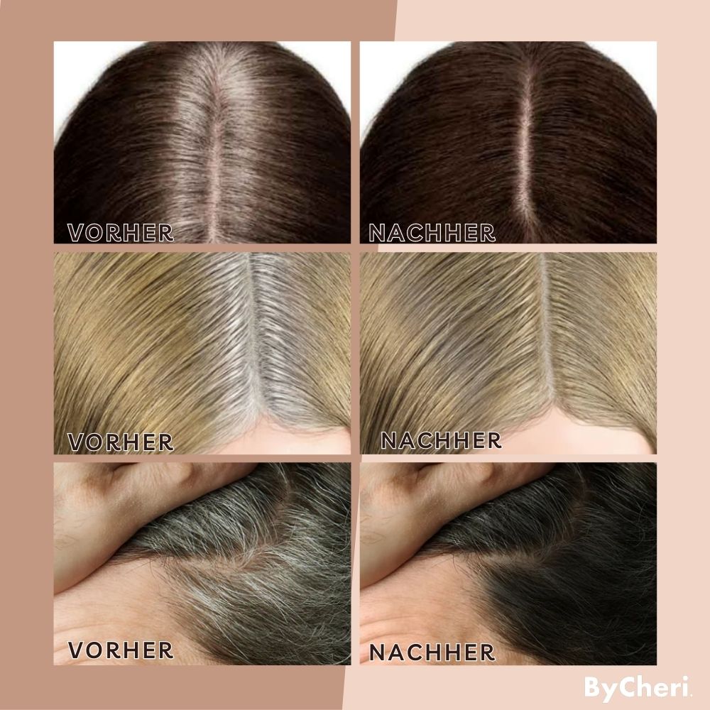 EasyBlend™ - Bye-Bye Hairline | 1+1 FREE TEMPORARY ONLY