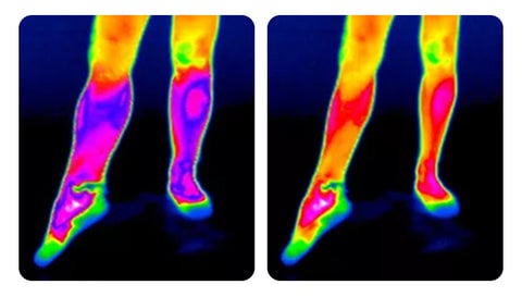 Self-heating knee brace: rapid pain relief