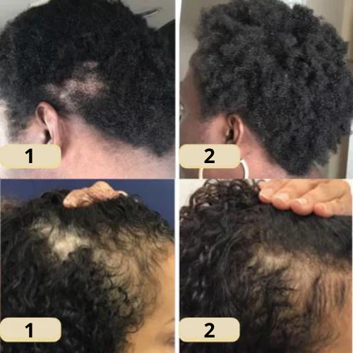 Rosemary-Infused Natural Hair Serum