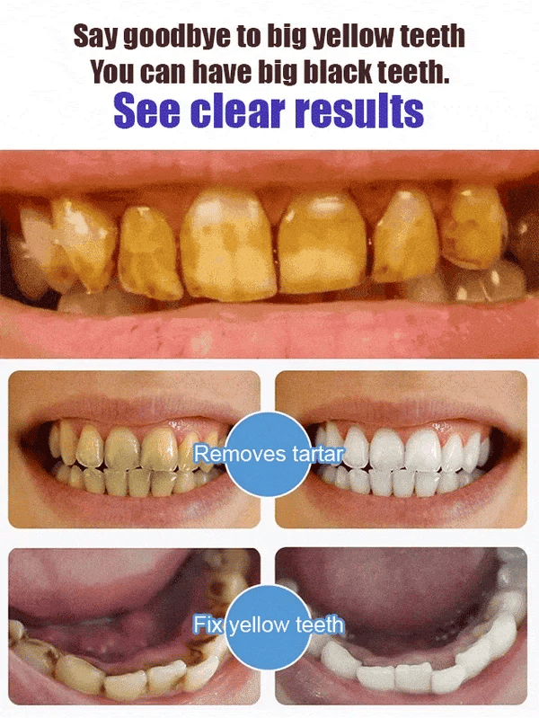 1+1 FREE | ProBrite™ Super Probiotic-6 Toothpaste