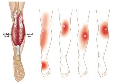 Self-heating knee brace: rapid pain relief