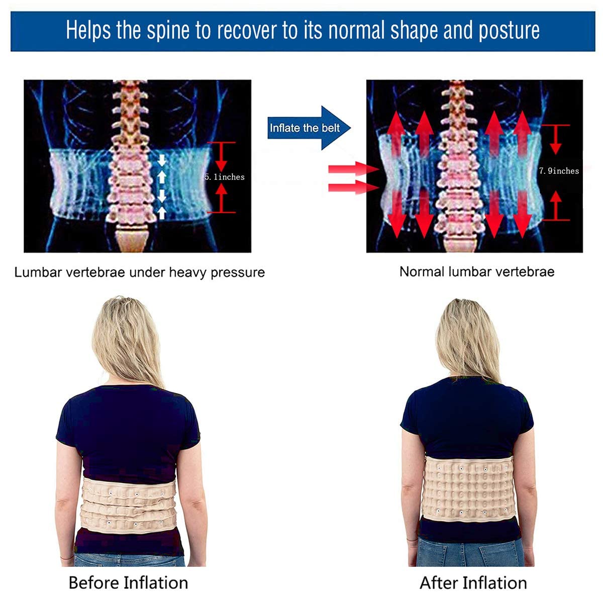 ComfortSpine™ - back stabiliser for pain-free movement