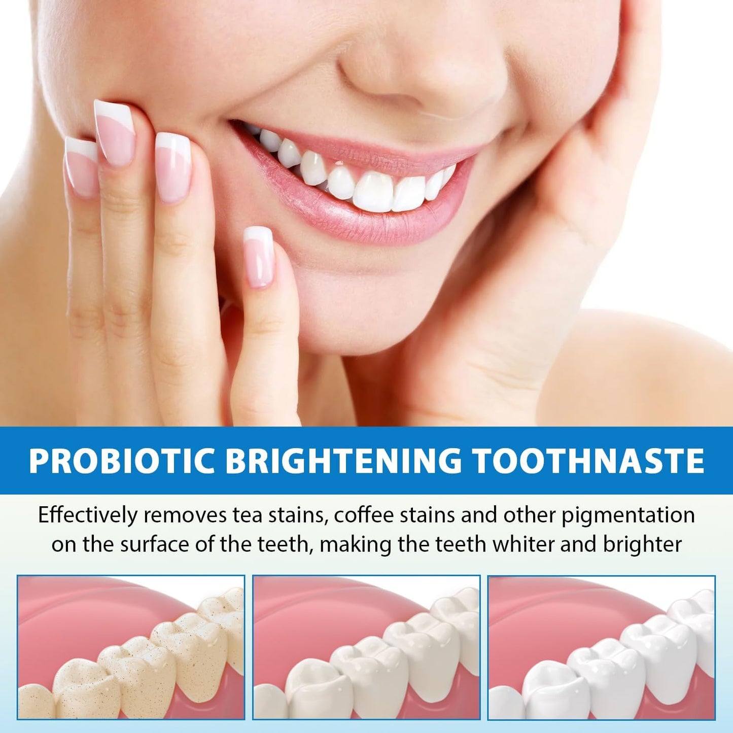 1+1 FREE | ProBrite™ Super Probiotic-6 Toothpaste