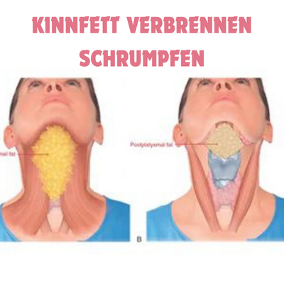 ContourV™ - Facial suction trainer