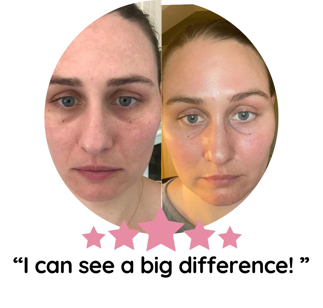 Turmeric Kojic Acid Pads