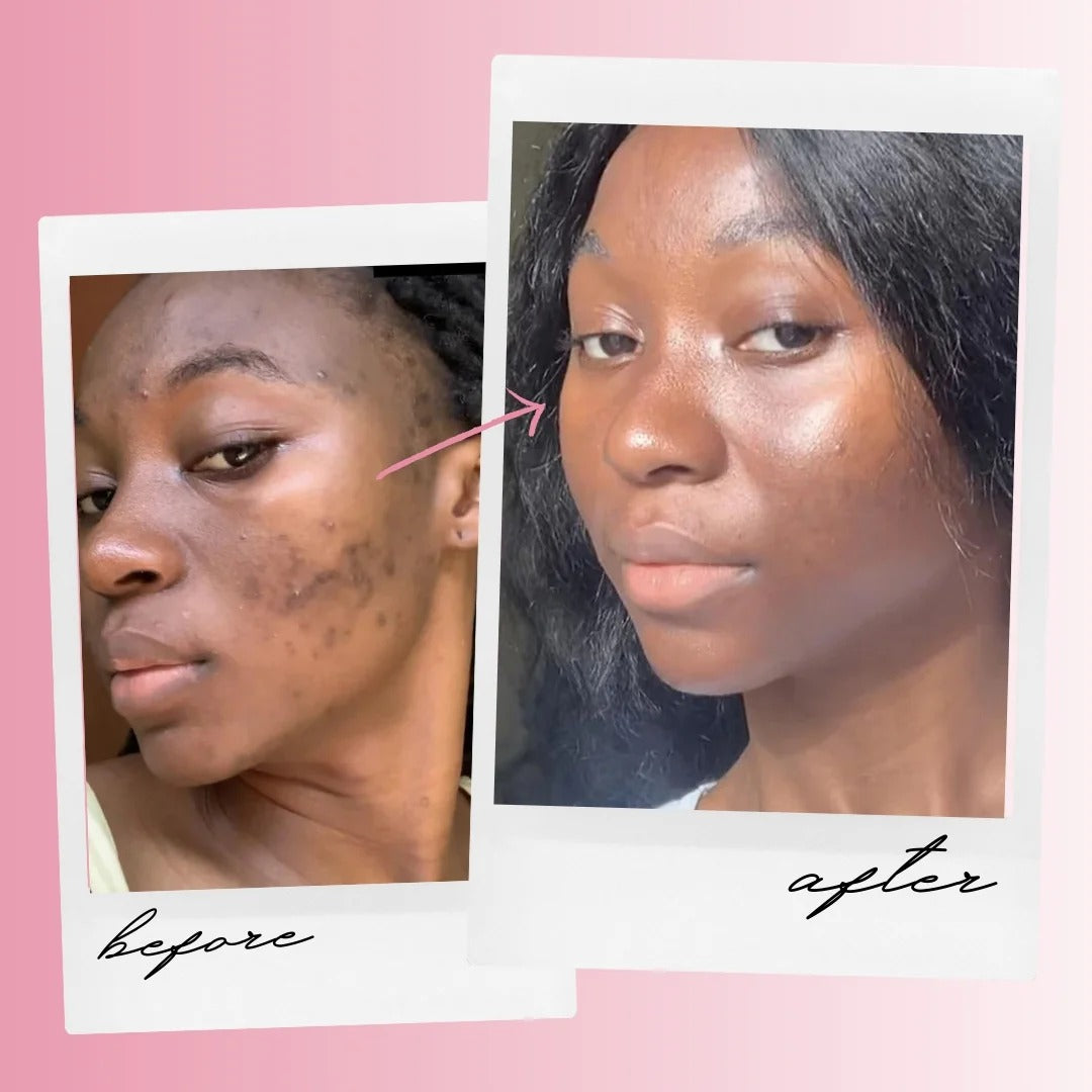 Turmeric Kojic Acid Pads