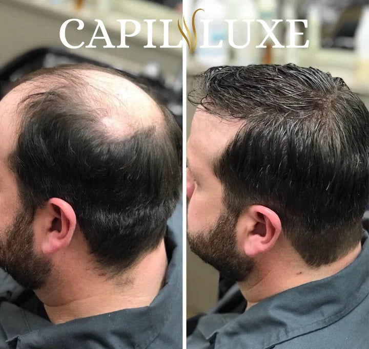 CapilLuxe™ | Reveal Your Gorgeous Hair: The #1 Regenerating Anti-Hair Loss Shampoo!