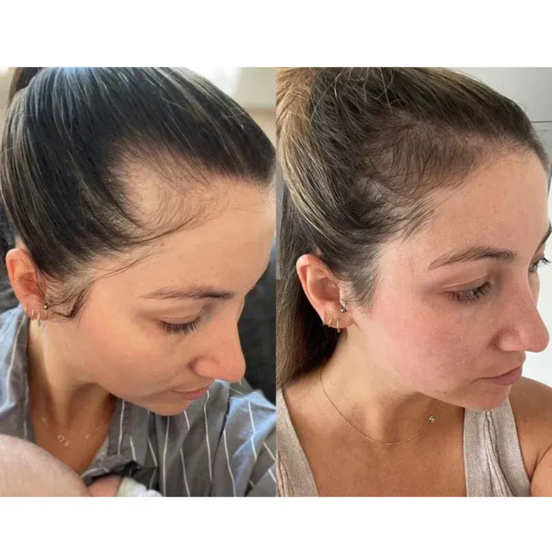 CapilLuxe™ | Reveal Your Gorgeous Hair: The #1 Regenerating Anti-Hair Loss Shampoo!
