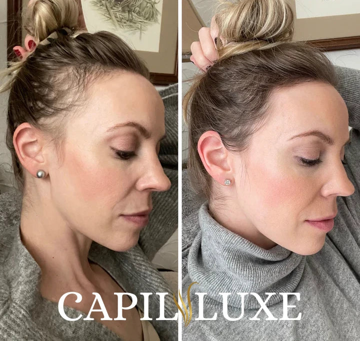 CapilLuxe™ | Reveal Your Gorgeous Hair: The #1 Regenerating Anti-Hair Loss Shampoo!