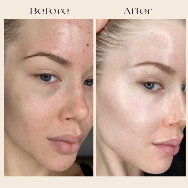 Deep Collagen Mask