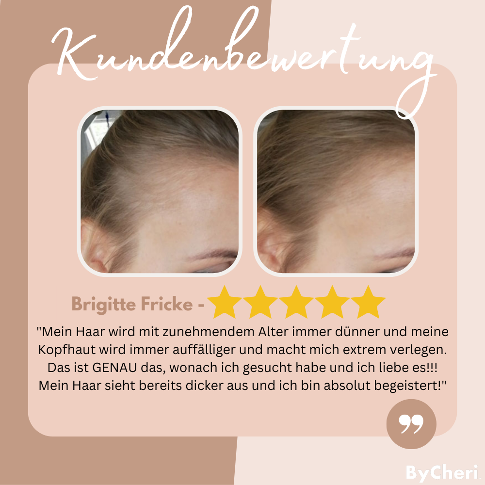 EasyBlend™ - Bye-Bye Hairline | 1+1 FREE TEMPORARY ONLY