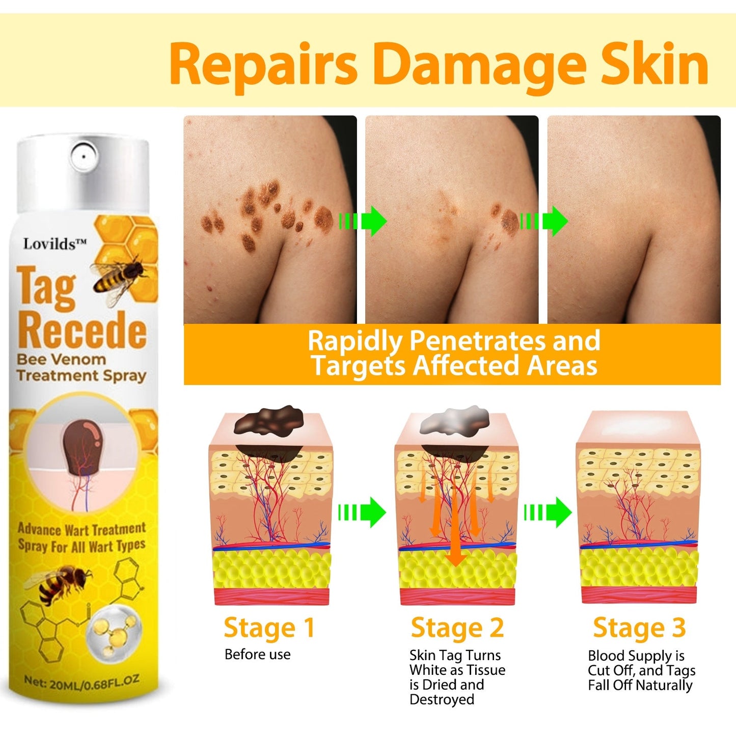 š LOVILDS⢠| TagRecede Bee Venom Treatment Spray