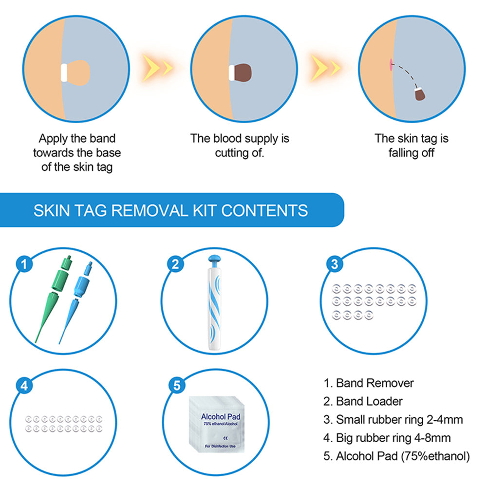 TagAway™ Advanced Skin Tag Removal Kit