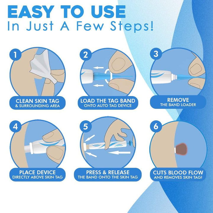 TagAway™ Advanced Skin Tag Removal Kit