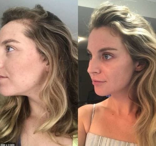 CapilLuxe™ | Reveal Your Gorgeous Hair: The #1 Regenerating Anti-Hair Loss Shampoo!