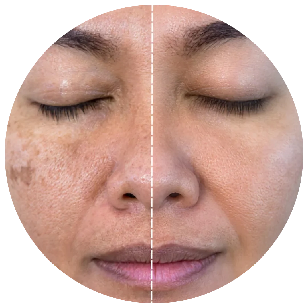 Turmeric Kojic Acid Pads