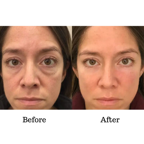 VerfonsEyes™️ Peptide Eye and Wrinkle Cream