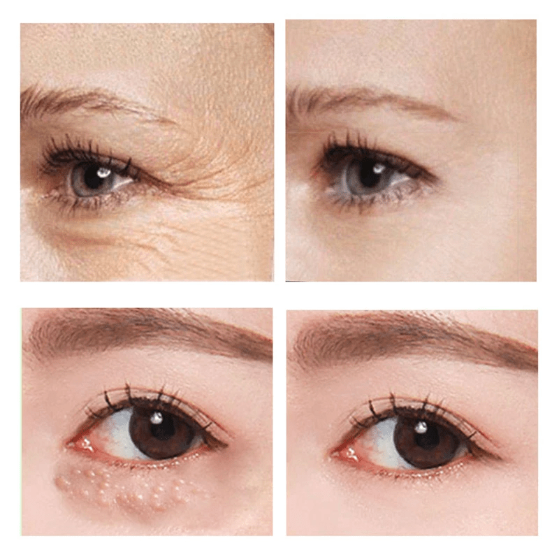VerfonsEyes™️ Peptide Eye and Wrinkle Cream