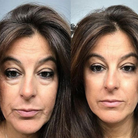 VerfonsEyes™️ Peptide Eye and Wrinkle Cream