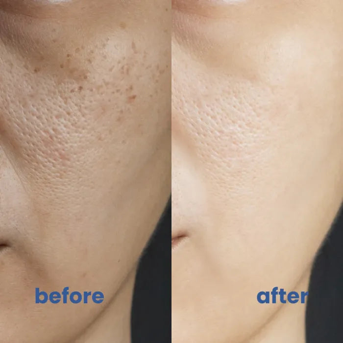 Skin Glow™ Perfect Coverage Solution