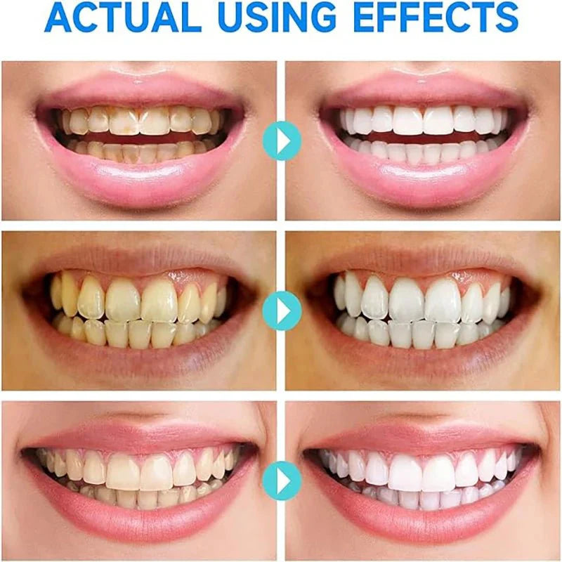 (1+1 FREE) PureTeeth™ Niacinamide Whitening Toothpaste