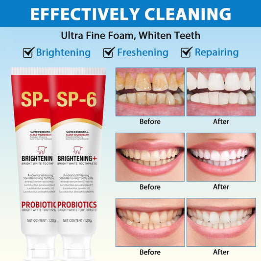 1+1 FREE | ProBrite™ Super Probiotic-6 Toothpaste