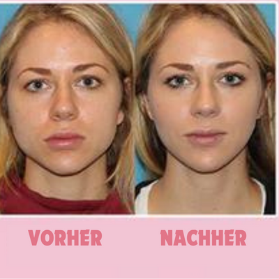 ContourV™ - Facial suction trainer