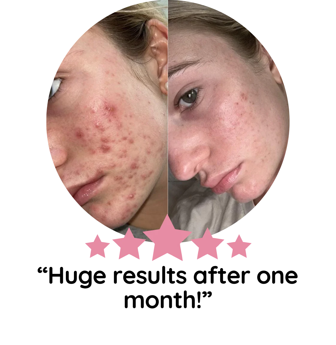 Turmeric Kojic Acid Pads