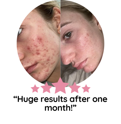 Turmeric Kojic Acid Pads