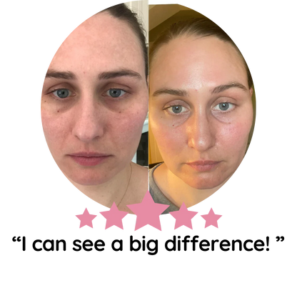 Turmeric Kojic Acid Pads