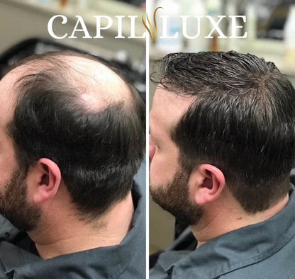 CapilLuxe™ | Reveal Your Gorgeous Hair: The #1 Regenerating Anti-Hair Loss Shampoo!
