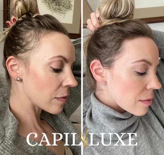 CapilLuxe™ | Reveal Your Gorgeous Hair: The #1 Regenerating Anti-Hair Loss Shampoo!