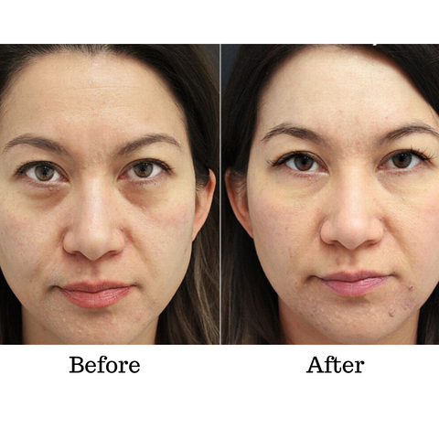 VerfonsEyes™️ Peptide Eye and Wrinkle Cream