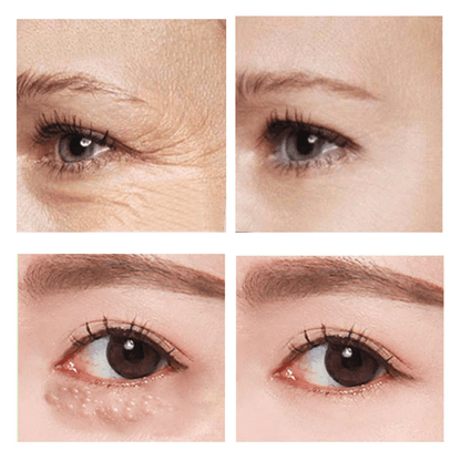 VerfonsEyes™️ Peptide Eye and Wrinkle Cream