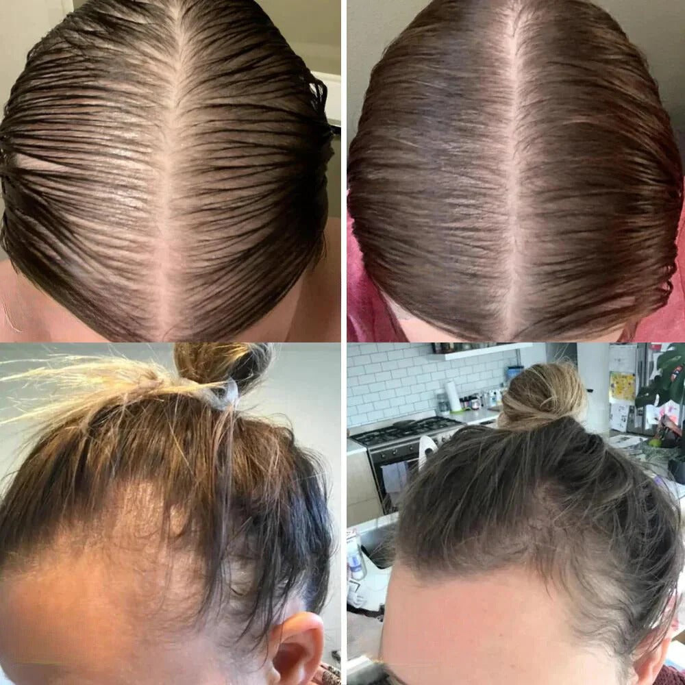 Rosemary-Infused Natural Hair Serum