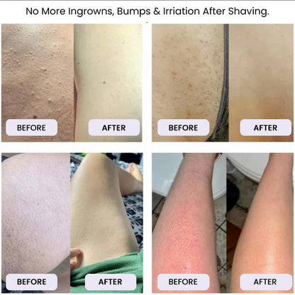RazyoGlow™ | Smooth Shave Razor (Includes 2 Gifts)